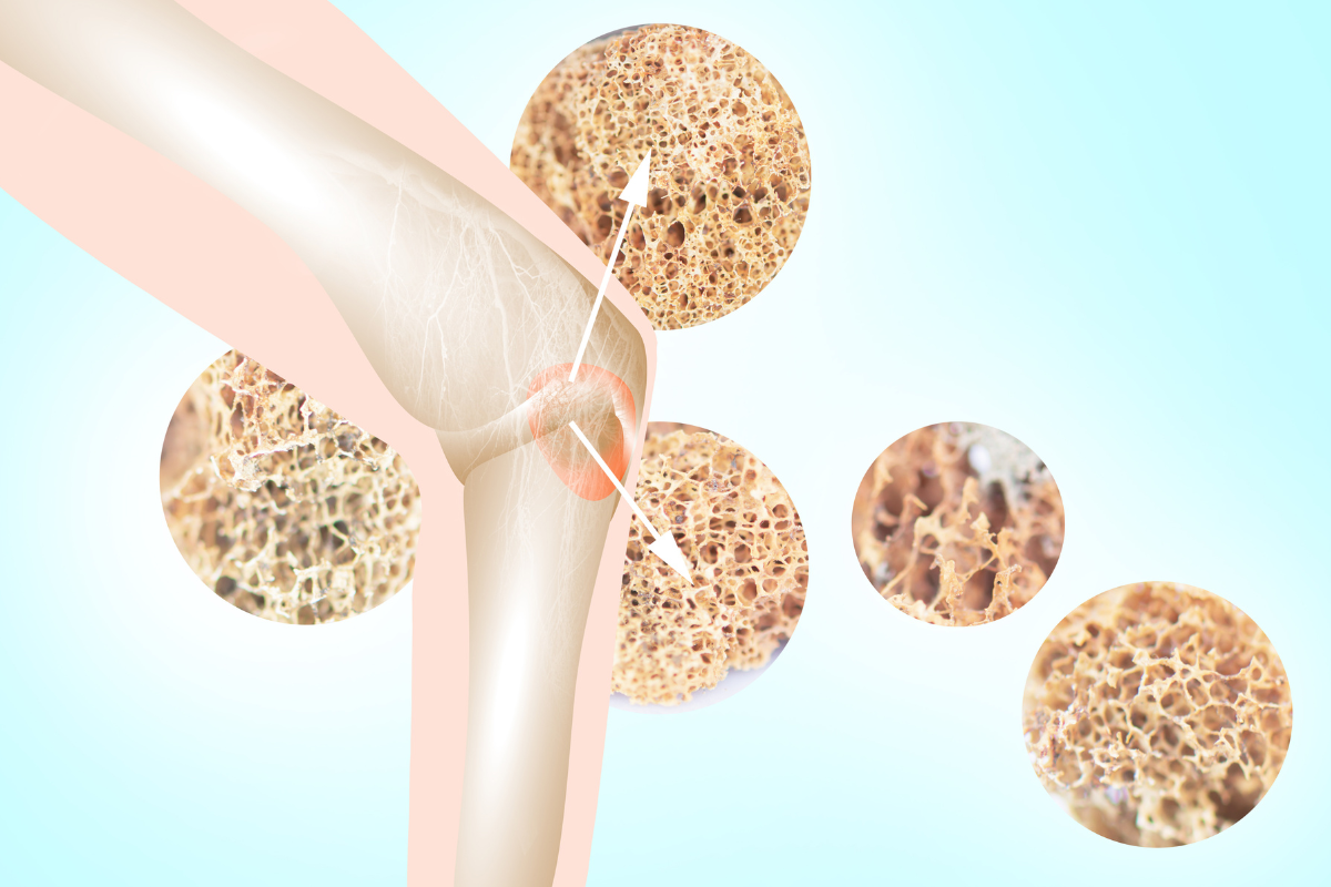 Bone Health – ITL Health EU/UK